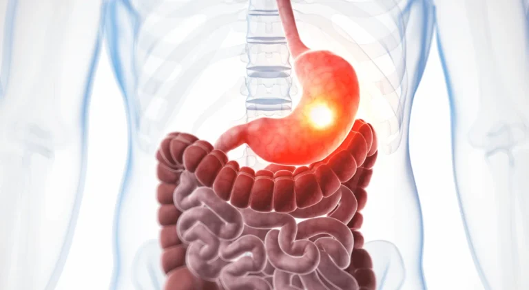 Mide kanseri endoskopi teşhis süreci