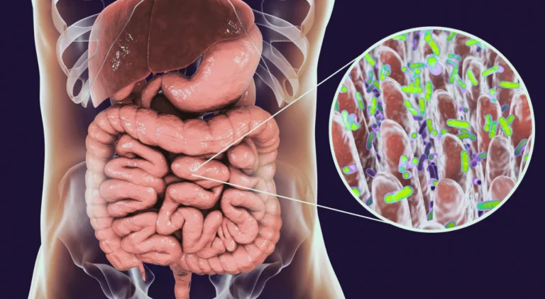 Kalın Bağırsak Kolon Kanseri Ameliyatı – Kolon kanseri cerrahisi ve sonrası süreç