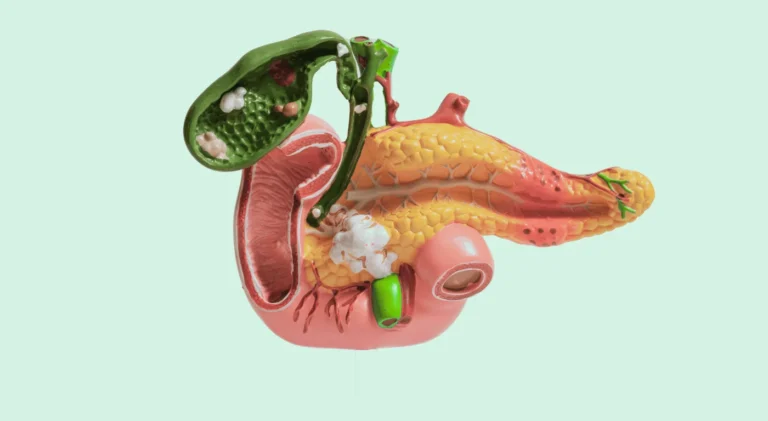 Total Pankreatektomi Pankreasın Tamamen Alınması Ameliyatı – Pankreas cerrahisi detayları