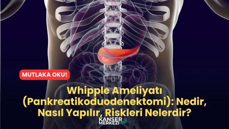 Whipple Ameliyatı (Pankreatikoduodenektomi) Nedir, Nasıl Yapılır, Riskleri Nelerdir