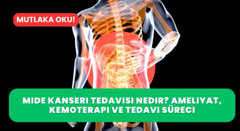 Mide Kanseri Tedavisi Nedir? Ameliyat, Kemoterapi ve Tedavi Süreci